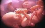 حول مشروع قانون الإجهاض